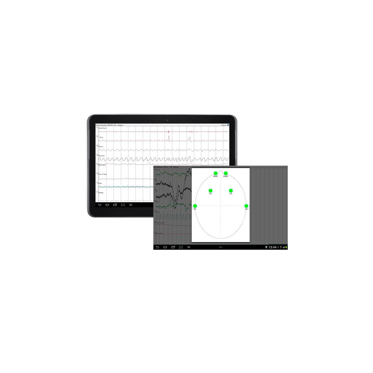 70-channel polysomnograph SOMNO HD image 3