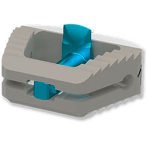 Cervical interbody fusion cage ARION