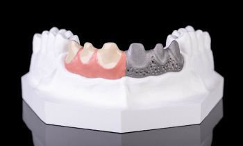 Composite dental material Metal Opaquer image 3