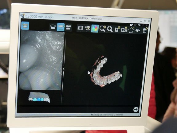 Digital facebow JMA image 4