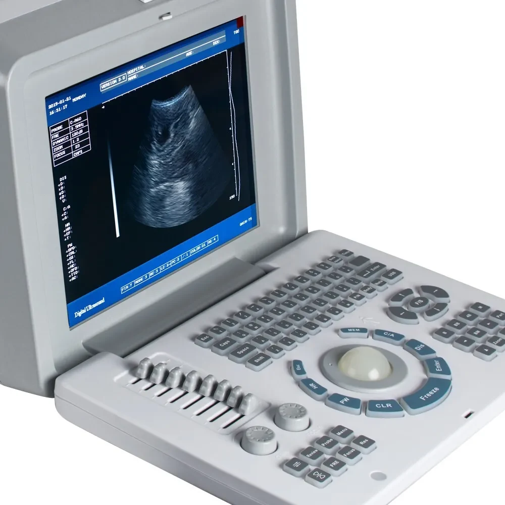 Digital Portable Full Ultrasound Machine Oriel Plus alternate view image 2