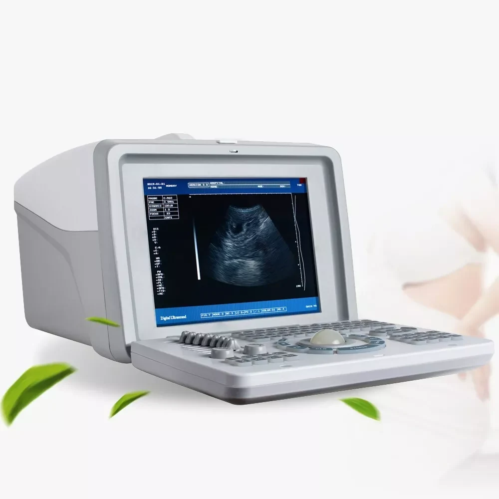 Digital Portable Full Ultrasound Machine Oriel Plus image 3