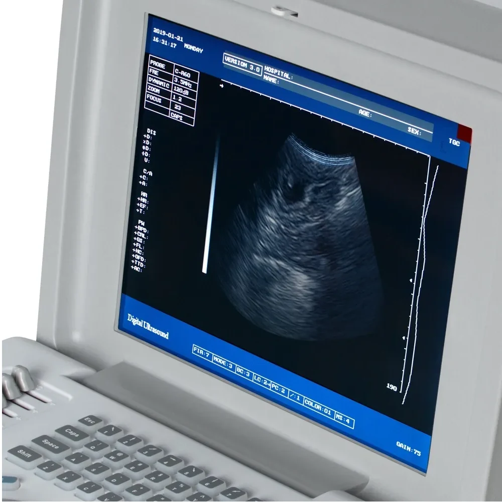Digital Portable Full Ultrasound Machine Oriel Plus image 4