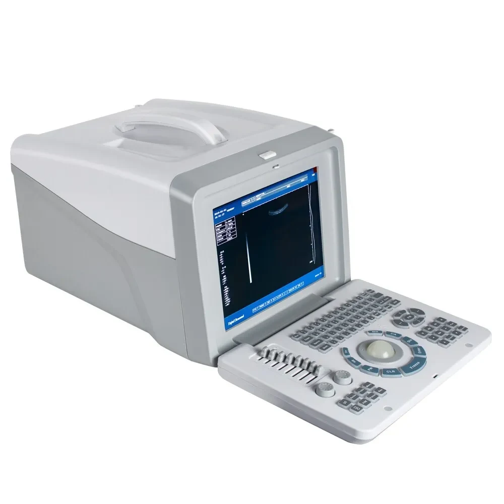 Digital Portable Full Ultrasound Machine Oriel Plus image 5
