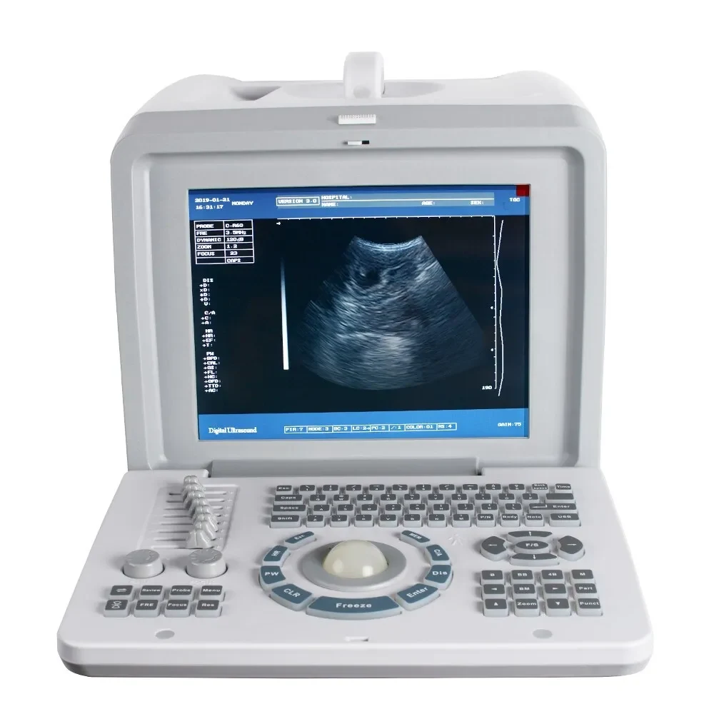Digital Portable Full Ultrasound Machine Oriel Plus