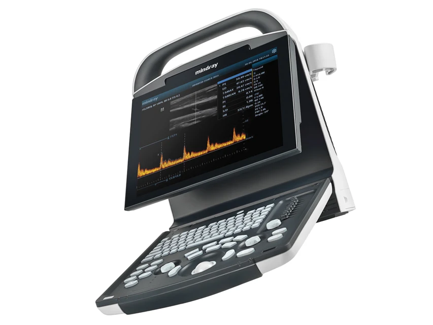 Digital Ultrasonic Diagnostic Imaging System DP-10 image 3