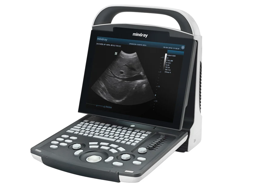 Digital Ultrasonic Diagnostic Imaging System DP-10 image 4