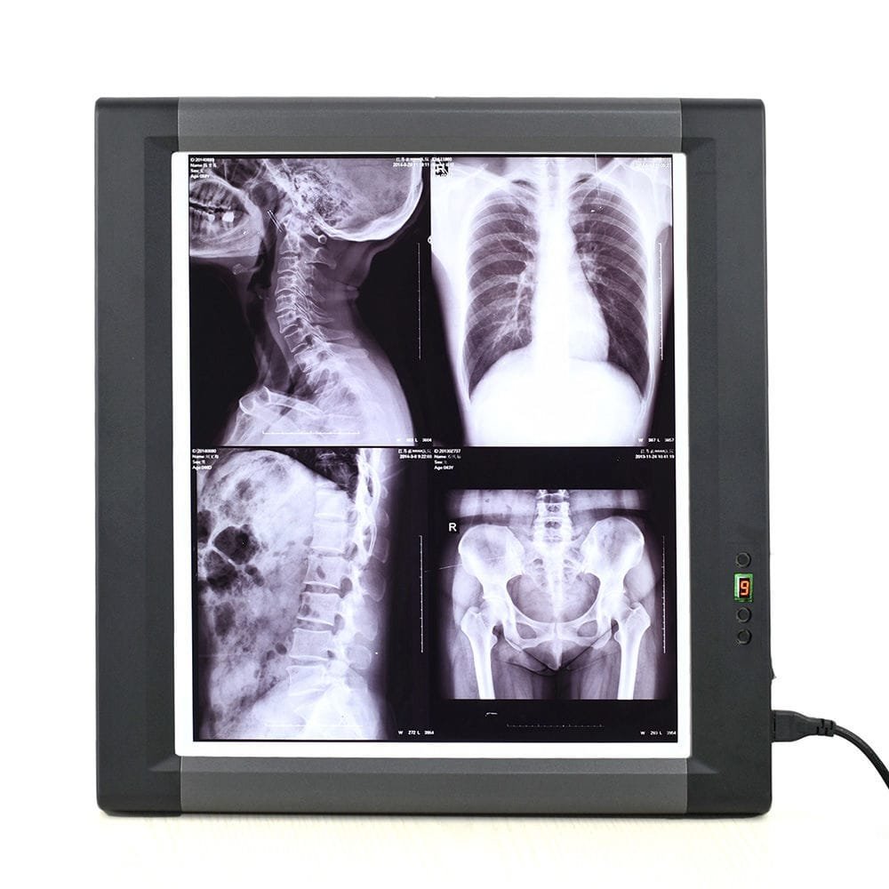 Digital X-ray film viewer MG01
