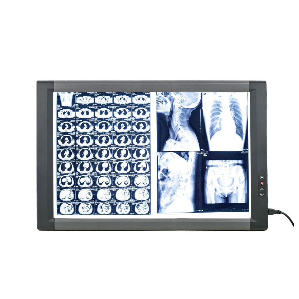 Digital X-ray film viewer MG02