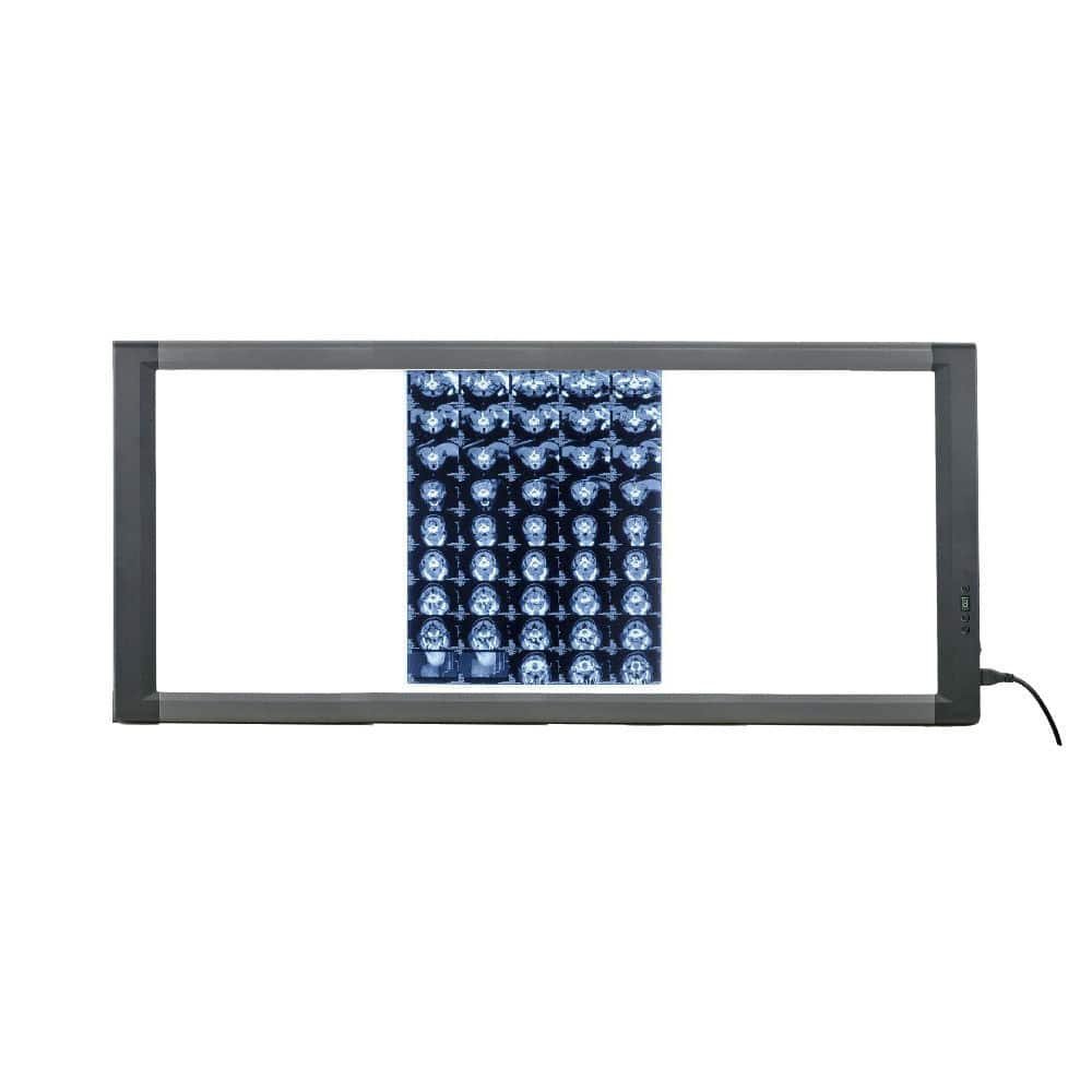 Digital X-ray film viewer MG03