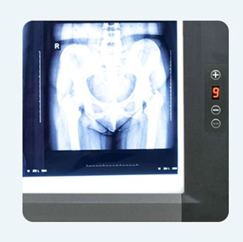 Digital X-ray film viewer MG04 image 2