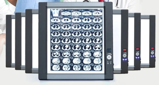 Digital X-ray film viewer ZG-2C alternate view image 2