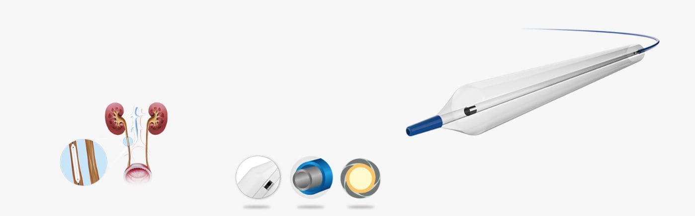 Dilatation catheter Prospect™ alternate view image 2