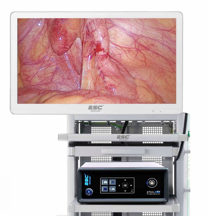 Endoscopic camera FHD-LP-5000 alternate view image 2