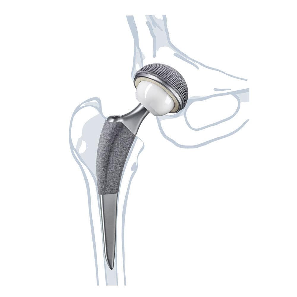 Femoral head prosthesis Isocer® alternate view image 2