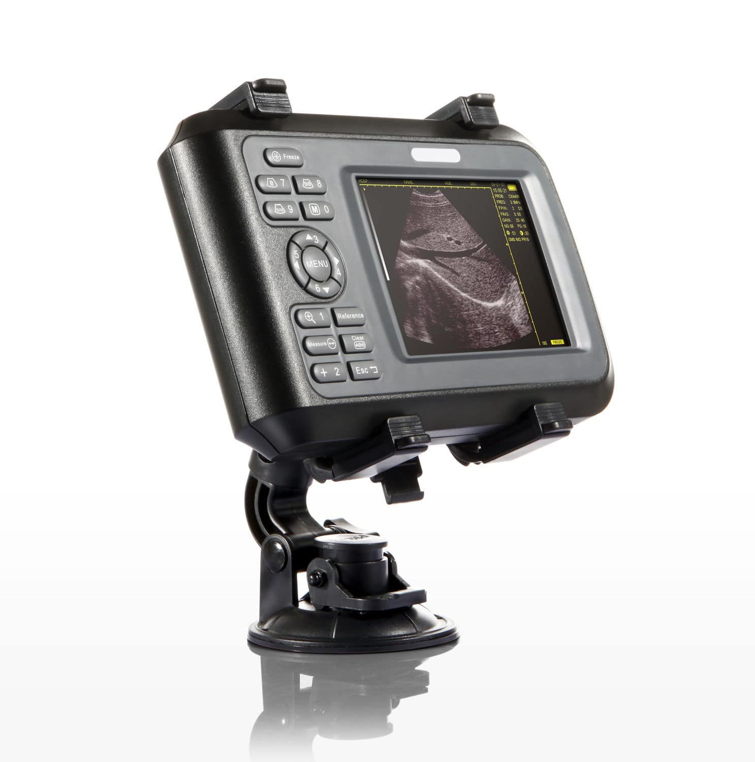 Hand-held ultrasound system DP-20A alternate view image 2