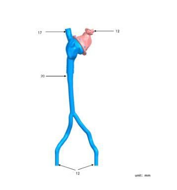 Heart model PLXG1012 image 8