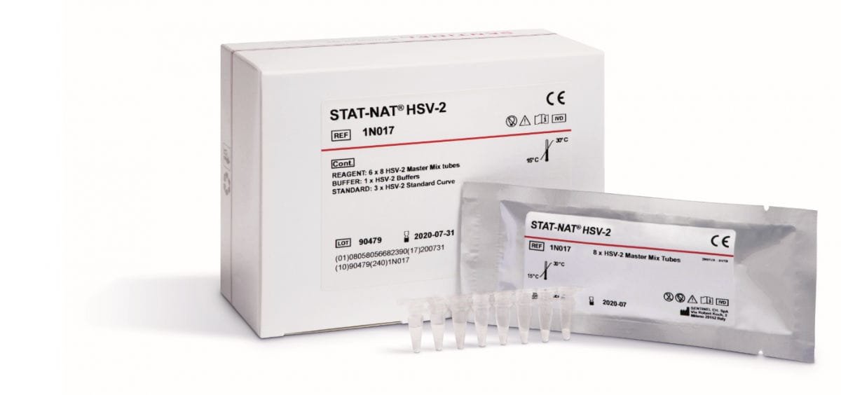 Herpes simplex virus reagent kit 1N017