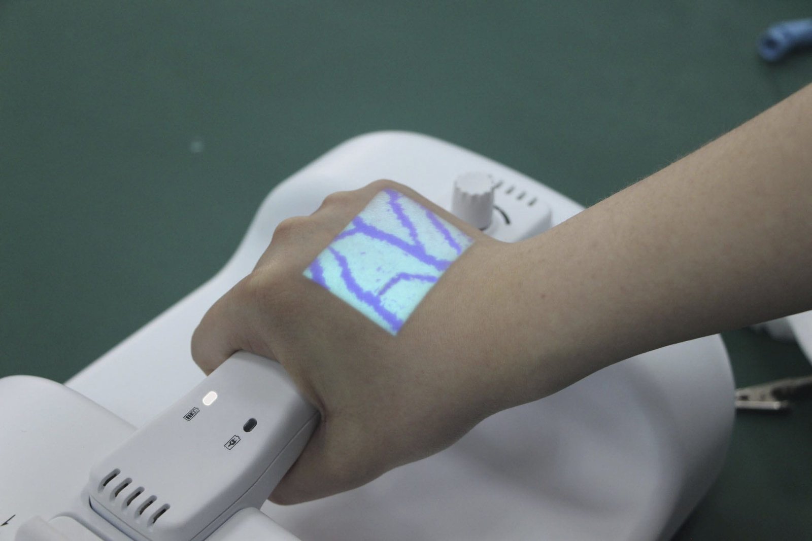 Infrared vein viewer BVF-266 image 4