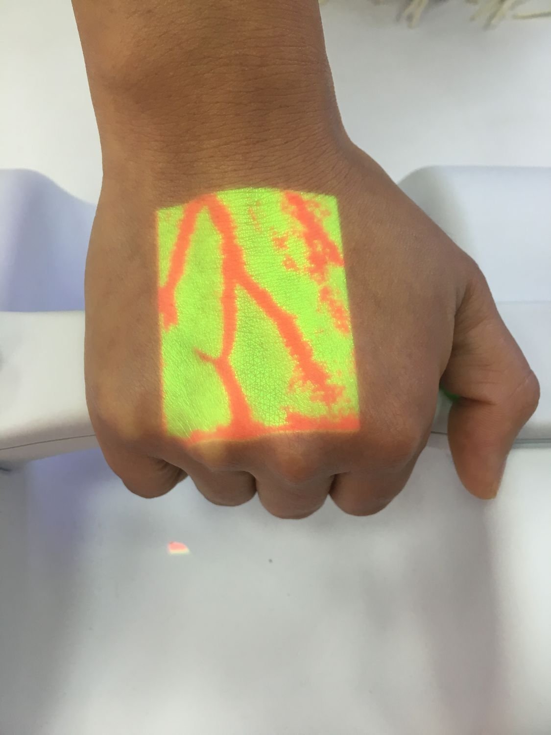 Infrared vein viewer BVF-266 image 5