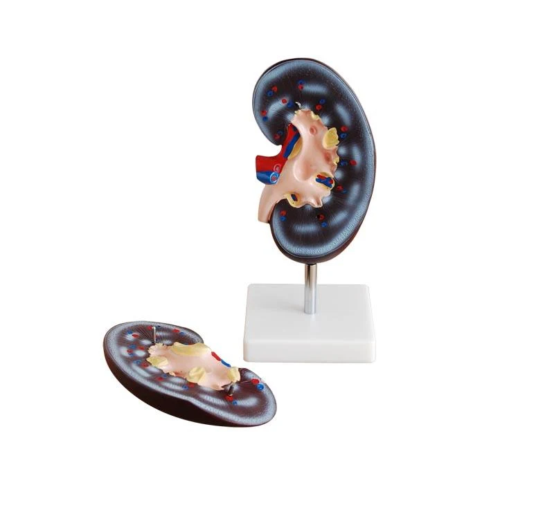 Kidney Model (2 parts)