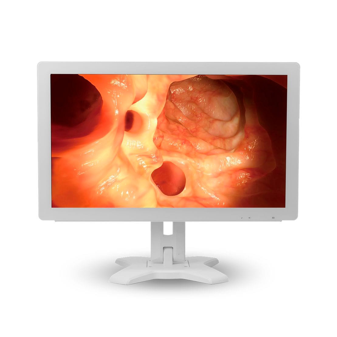Medical display MMS-21C-R11