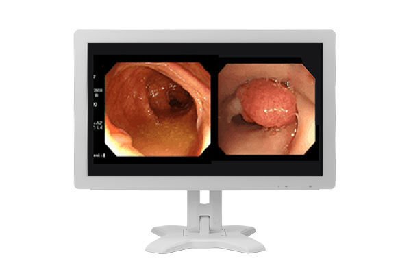 Medical display MMS-21CAHST image 4