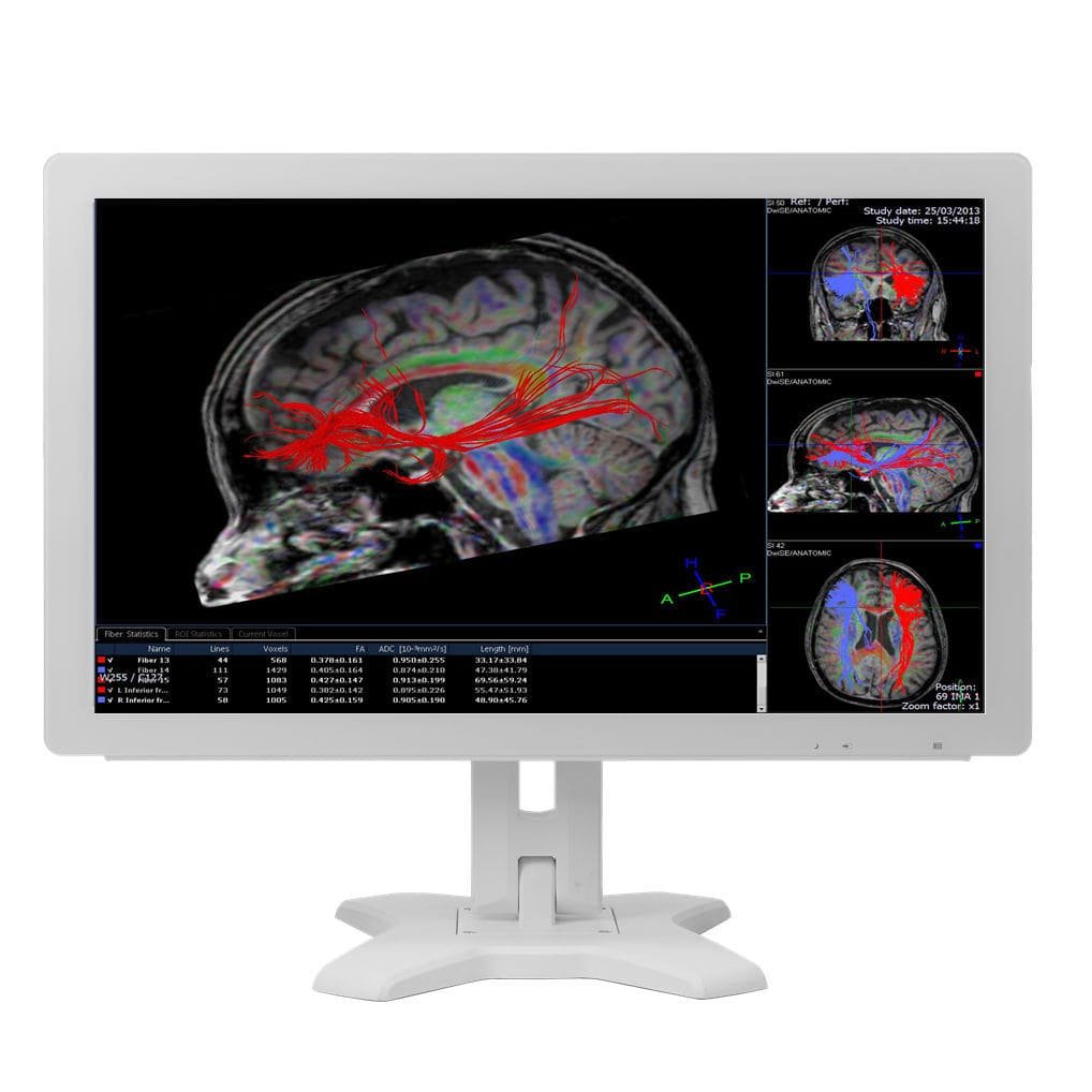 Medical display MMS-21CAHST