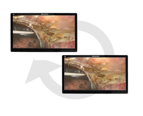 Medical display S2785P image 5