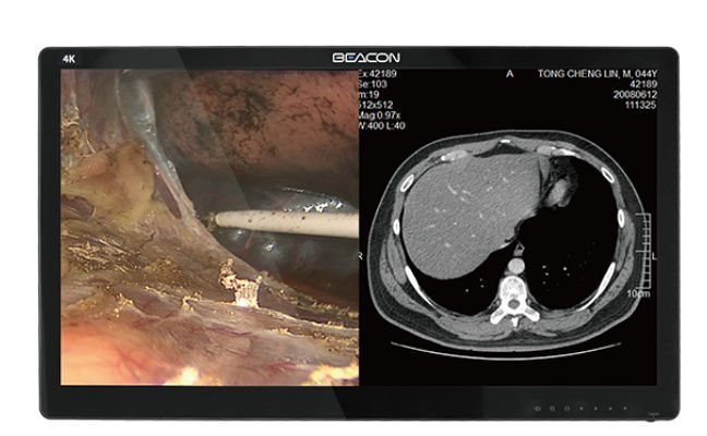 Medical display S2785P image 6