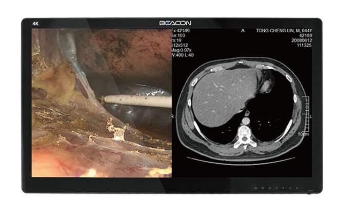 Medical display S5583P image 5