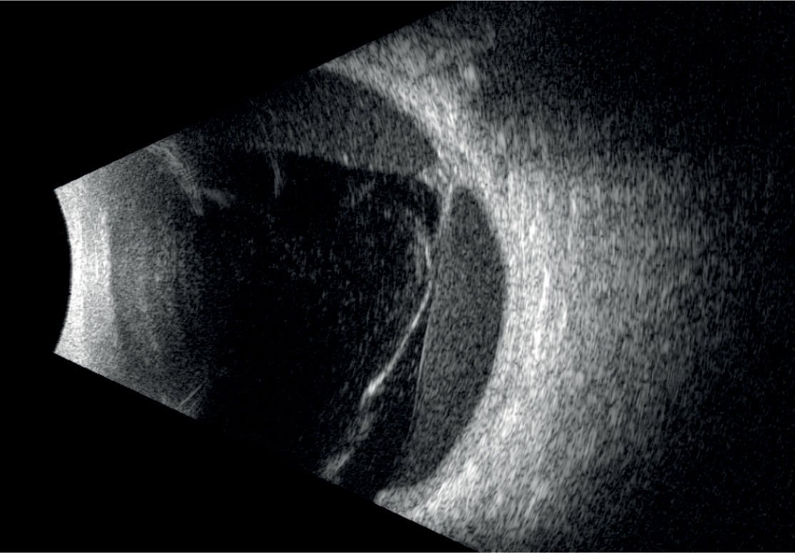 On-platform, tabletop ultrasound system ABSolu image 2