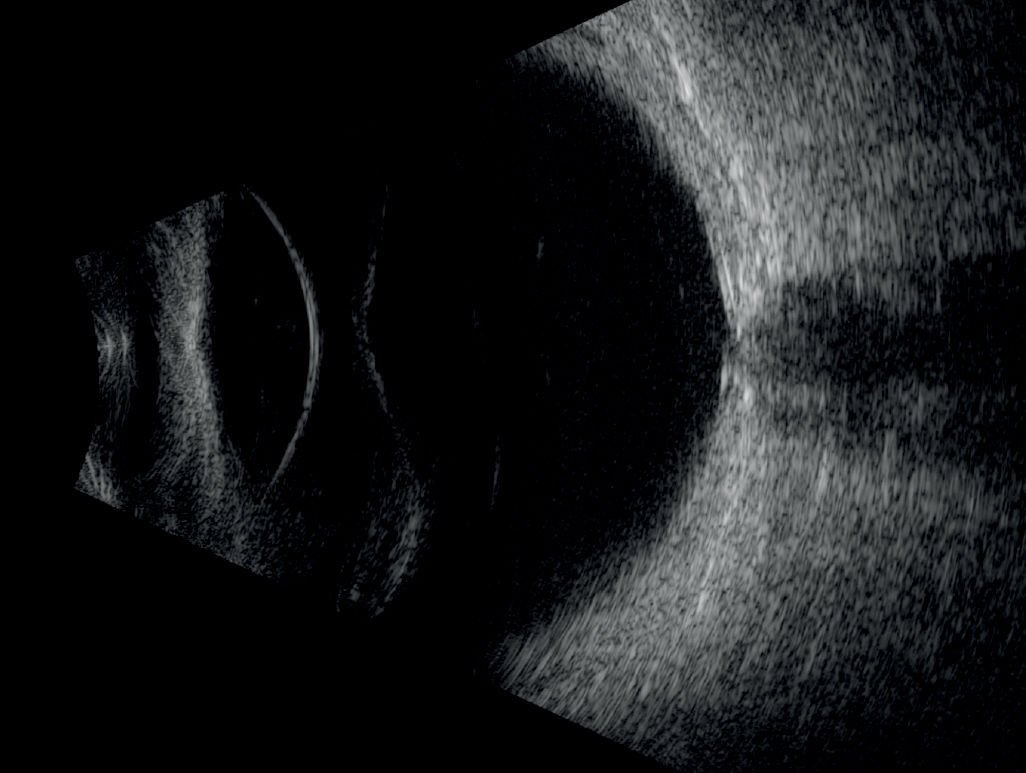 On-platform, tabletop ultrasound system ABSolu image 3