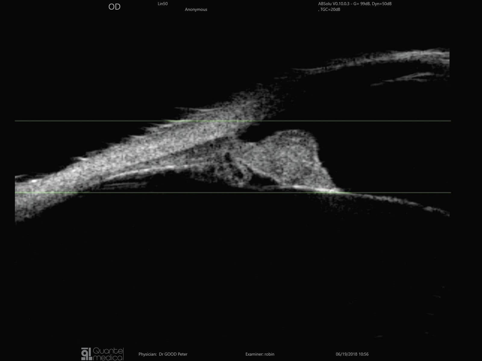 On-platform, tabletop ultrasound system ABSolu image 4