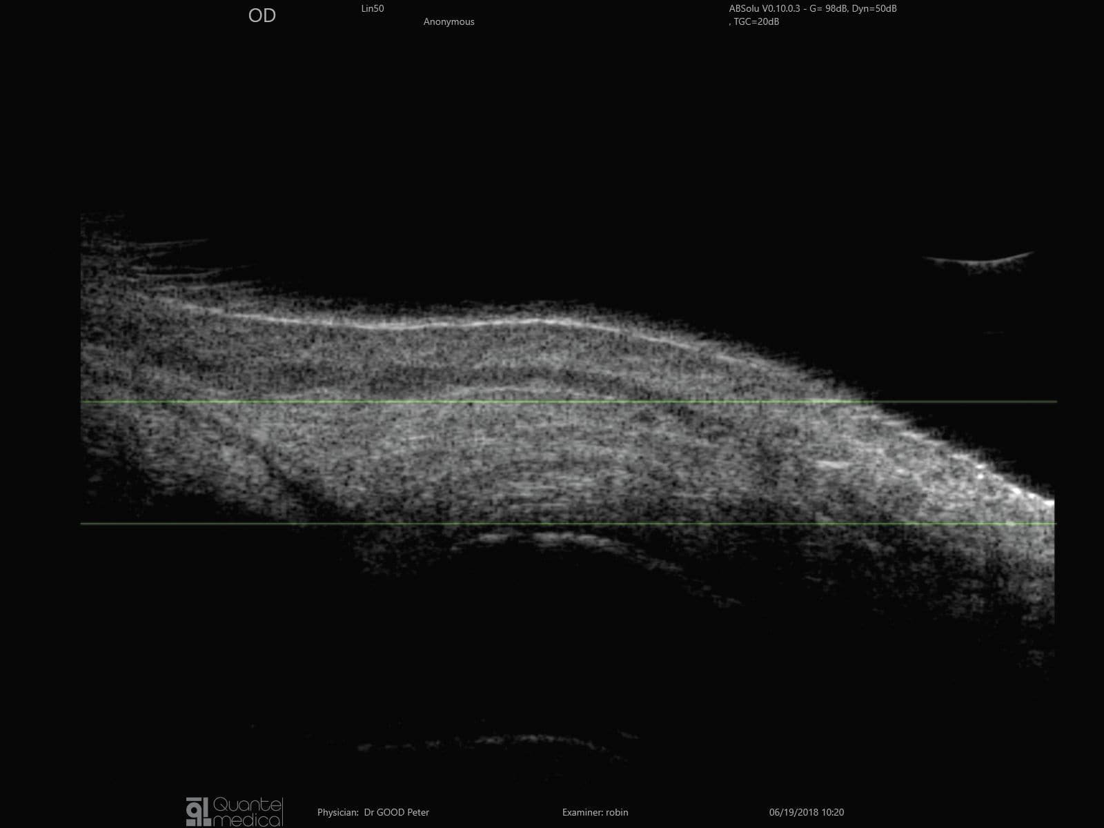 On-platform, tabletop ultrasound system ABSolu image 5