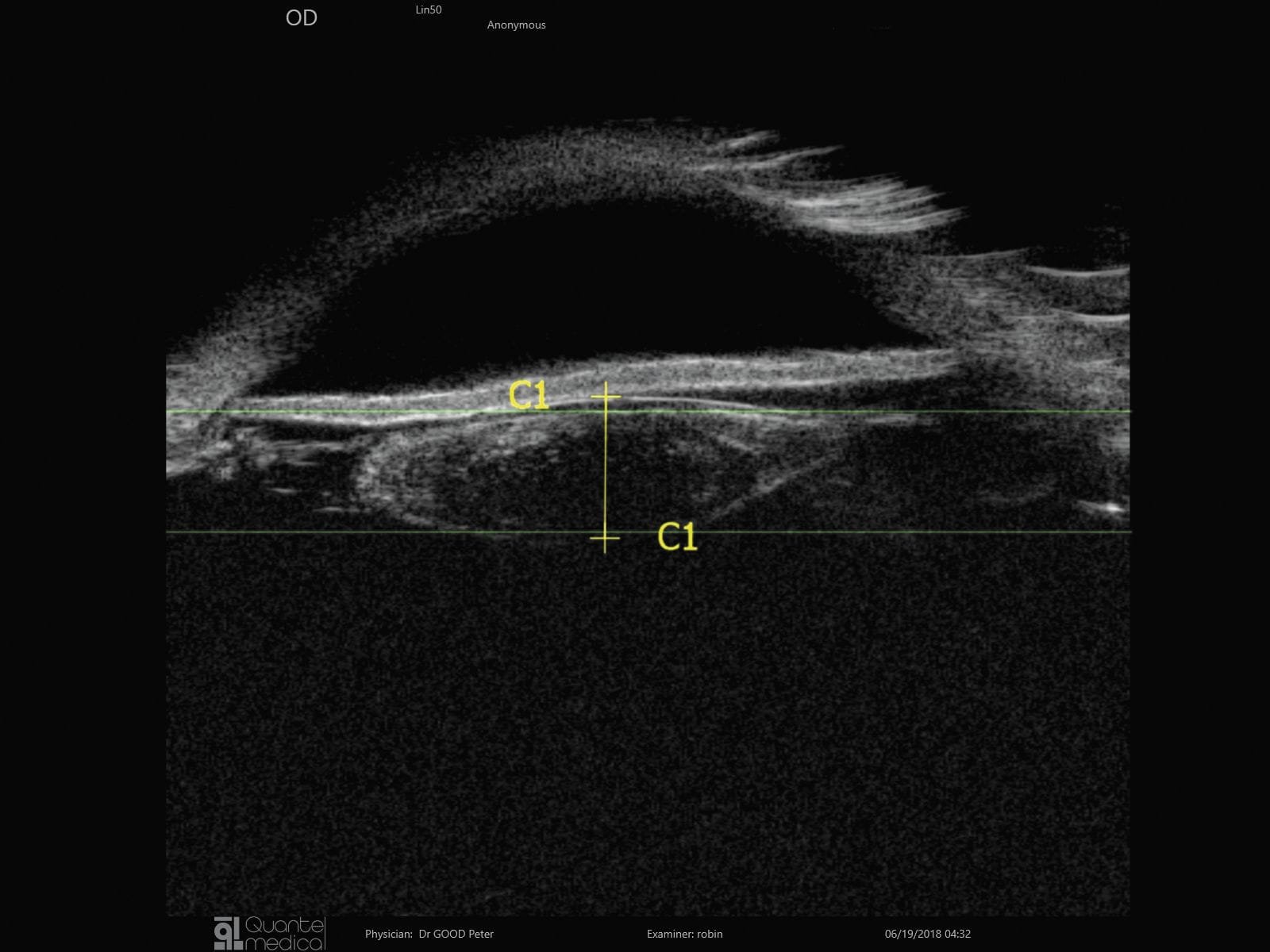 On-platform, tabletop ultrasound system ABSolu image 6