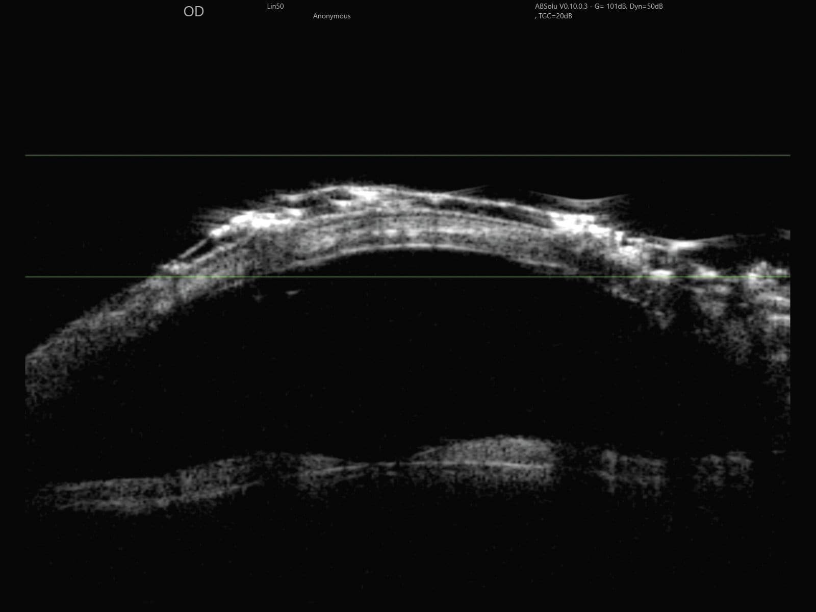 On-platform, tabletop ultrasound system ABSolu image 7