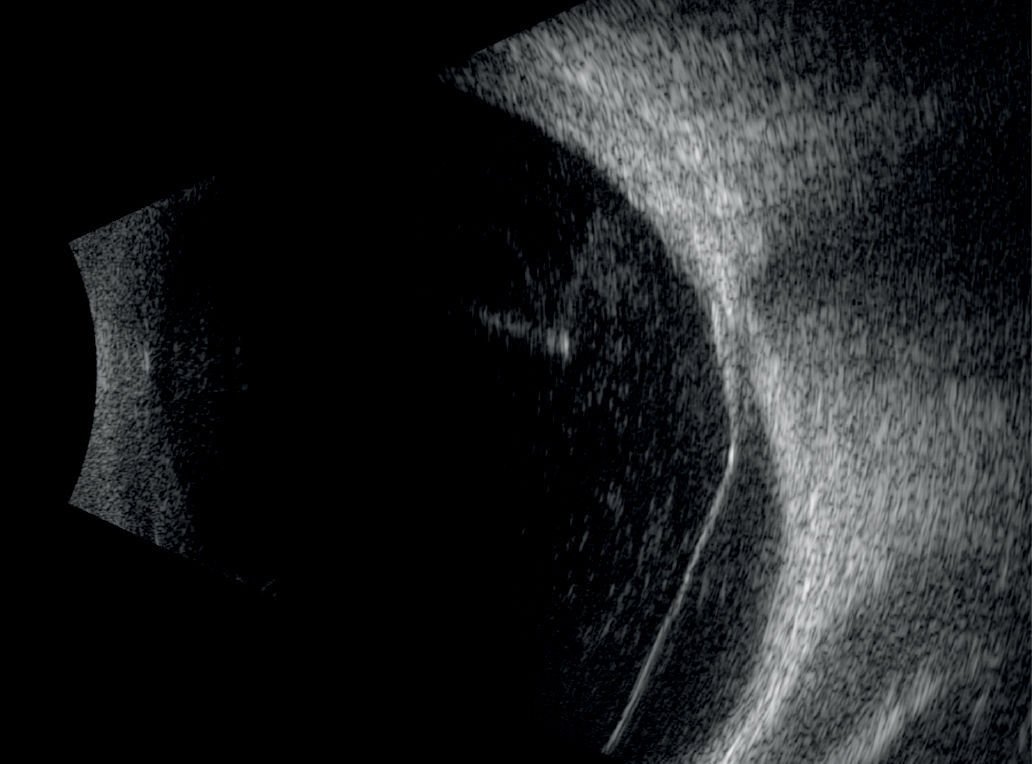 On-platform, tabletop ultrasound system ABSolu image 8