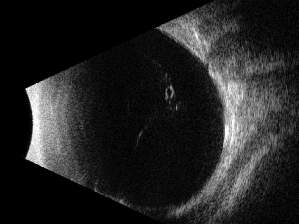 On-platform, tabletop ultrasound system ABSolu image 9