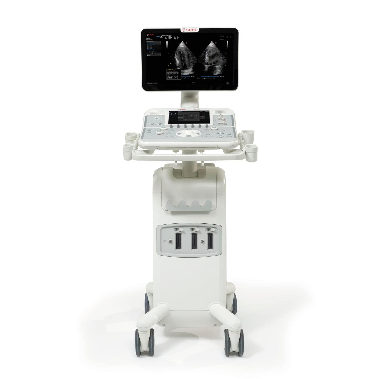 On-platform ultrasound system MyLab™X5