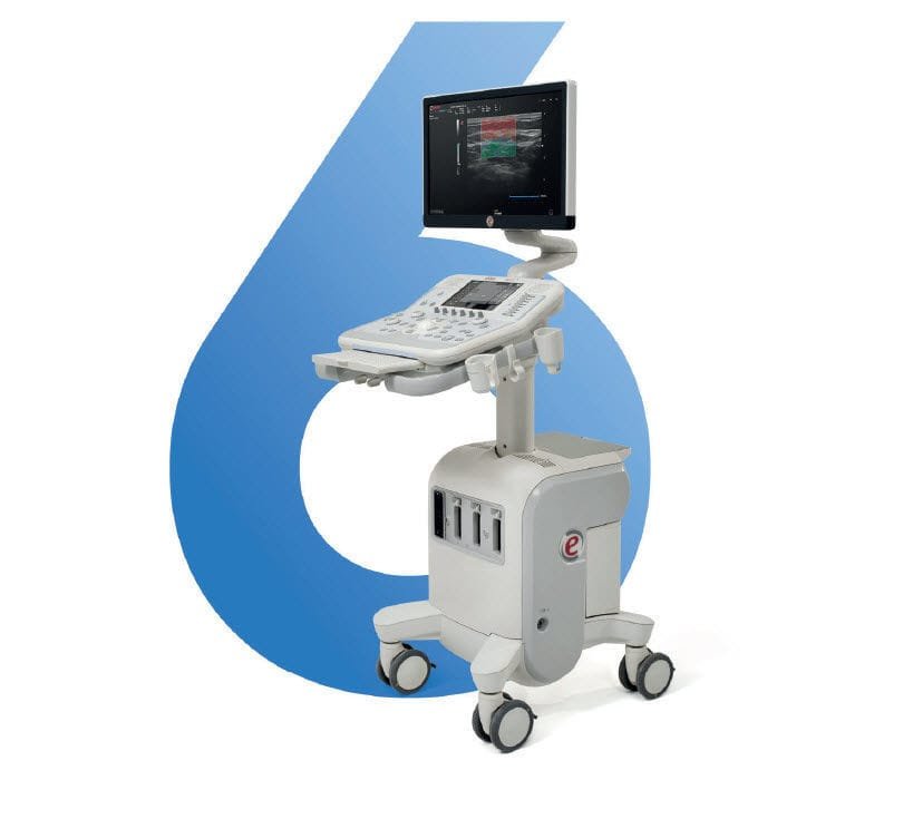 On-platform ultrasound system MyLab™X6 image 3