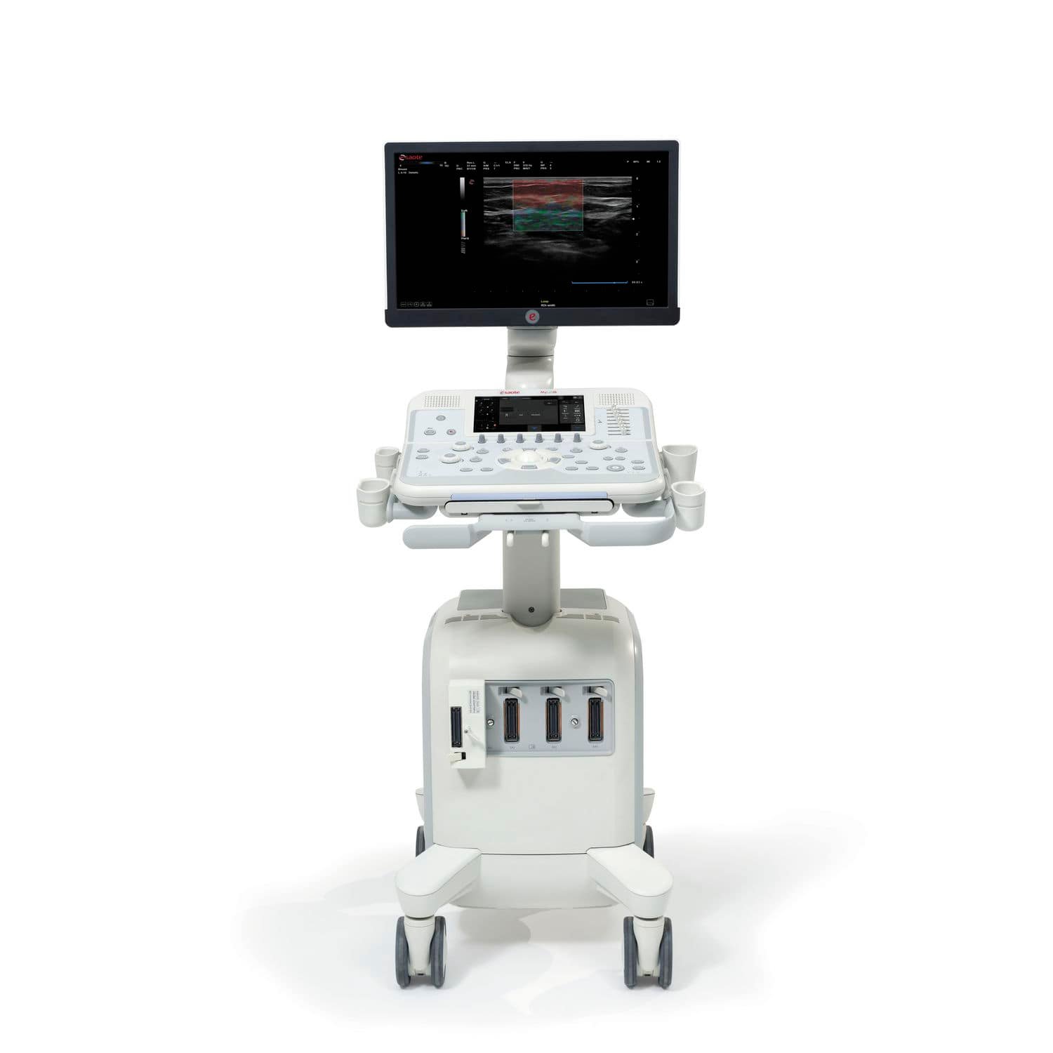 On-platform ultrasound system MyLab™X6