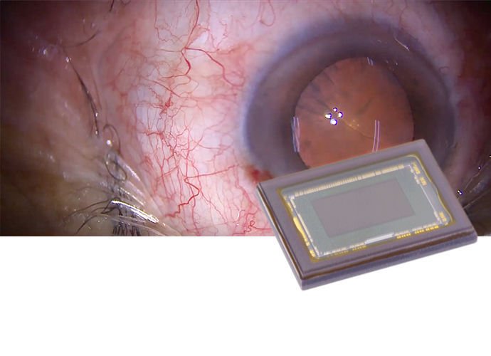 Operating microscope video camera MCC-1000MD image 4