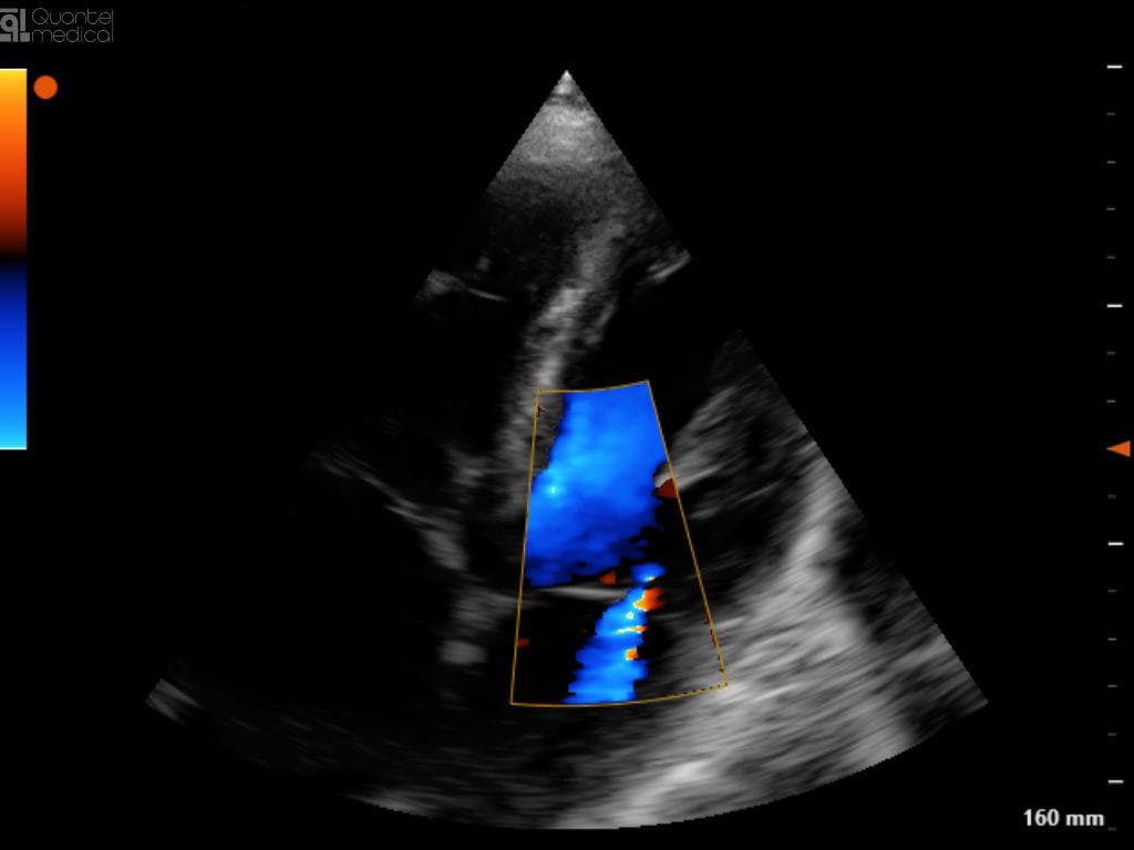 Portable ultrasound system EvoTouch+ image 3