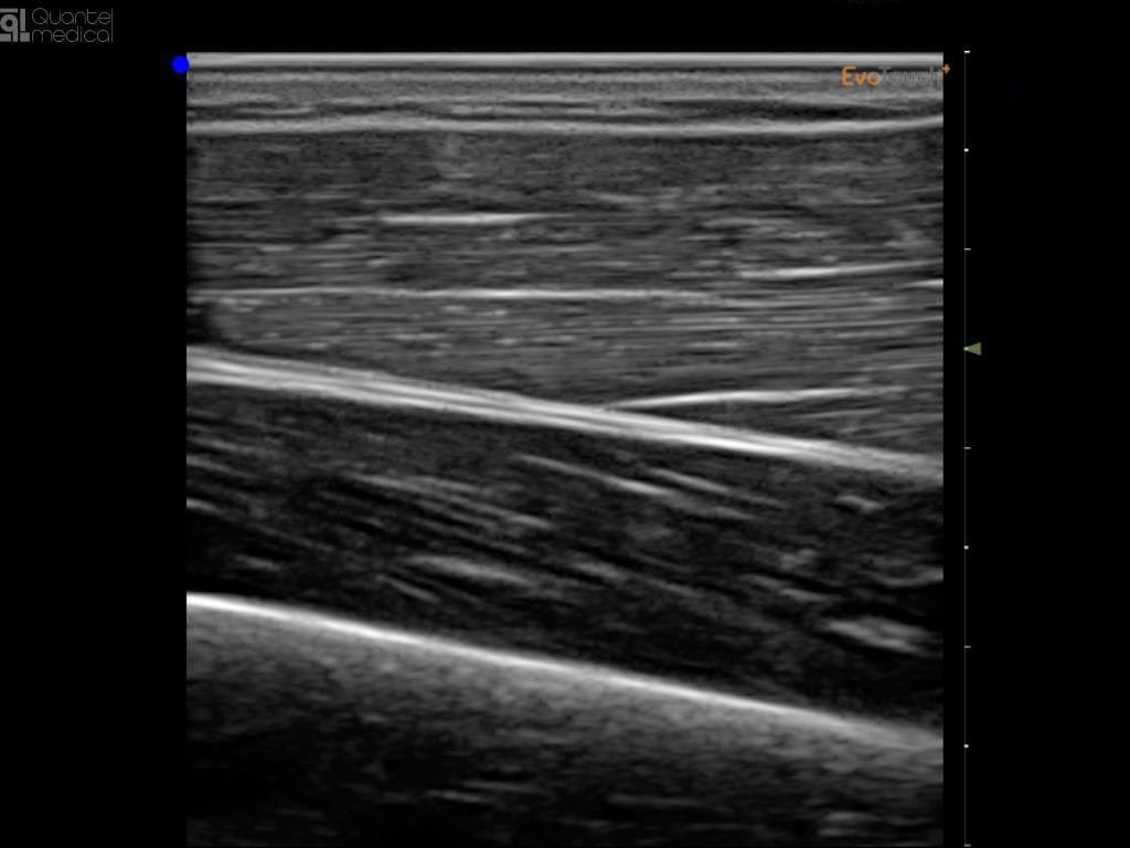 Portable ultrasound system EvoTouch+ image 4