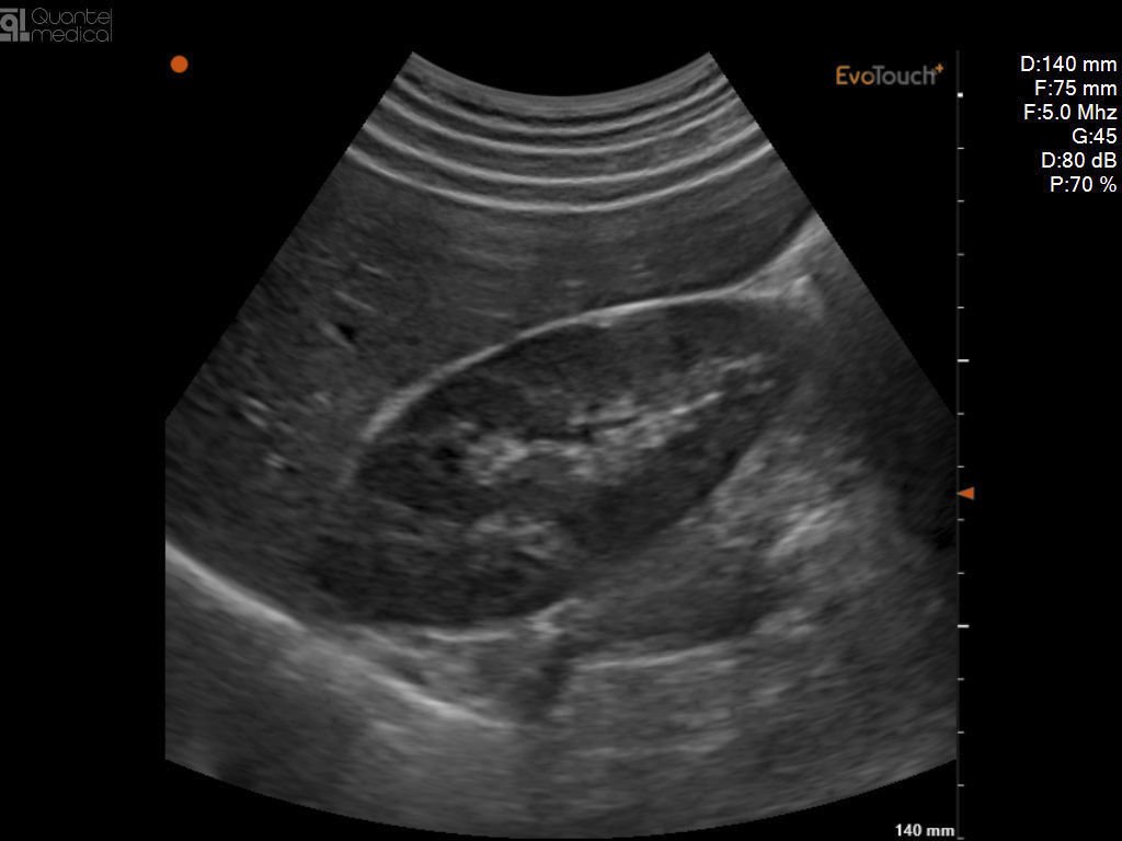 Portable ultrasound system EvoTouch+ image 5