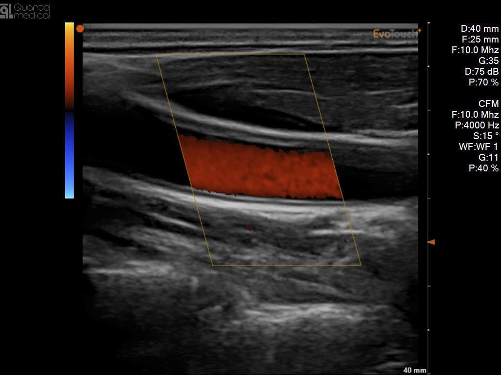 Portable ultrasound system EvoTouch+ image 6