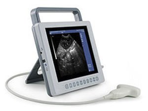 Portable ultrasound system K10 image 4