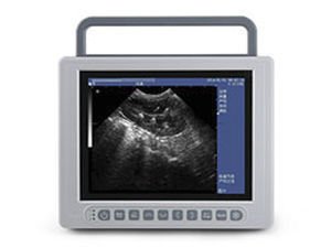 Portable ultrasound system K10 image 5