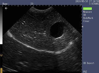 Portable ultrasound system K10 image 6